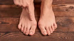 Hallux valgus  Fußfehlstellung Klettern