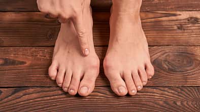 Hallux valgus  Fußfehlstellung Klettern