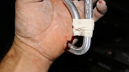 KL Unfall Karabiner in Hand KL Unfall Karabiner in Hand