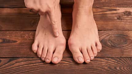 Hallux valgus Fußfehlstellung Klettern Hallux valgus Fußfehlstellung Klettern