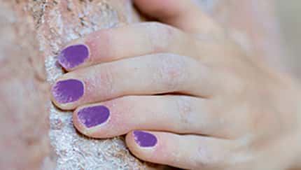 KL Lackierte Nägel beim Bouldern