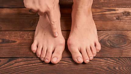 Hallux valgus  Fußfehlstellung Klettern